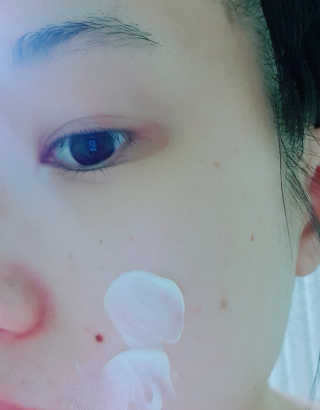 나이팅게일 티타민 크림 리뉴얼 — 3.33점을 준 리뷰어가 2018년 4월 올린 사용 사진
