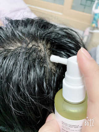 달리프 클로렐라 베러 루트 헤어토닉 100ml — 5점을 준 리뷰어가 2018년 12월 올린 사용 사진