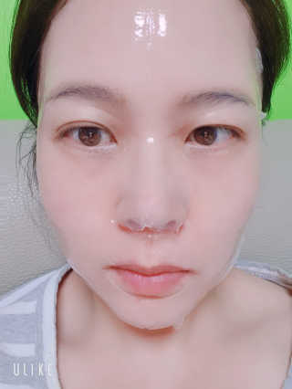 셀더마 마린 콜라겐 하이드로겔 마스크팩 5박스 — 5점을 준 리뷰어가 2020년 3월 올린 사용 사진