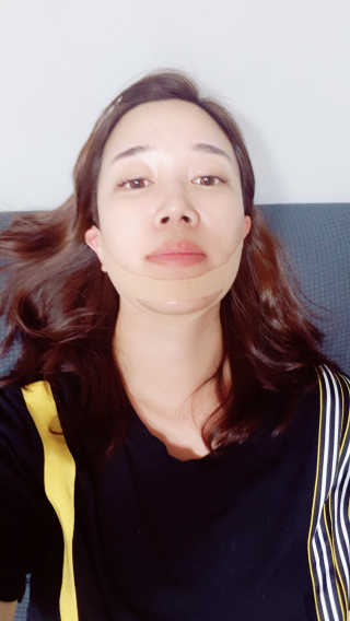 아이디플라코스메틱 아이디 페이스핏 마이너스 밴드 — 5점을 준 리뷰어가 2019년 9월 올린 사용 사진