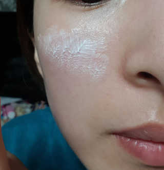 아이소이 불가리안 로즈 블레미쉬 케어 스팟_잡티스팟 — 4점을 준 리뷰어가 2018년 4월 올린 사용 사진