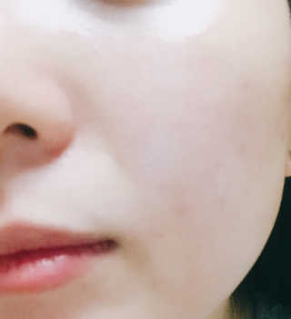 아크웰 에이씨 나이트 리페어 크림 — 5점을 준 리뷰어가 2018년 12월 올린 사용 사진