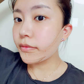 아이디플라코스메틱 아이디 페이스핏 마이너스 밴드 — 5점을 준 리뷰어가 2019년 9월 올린 사용 사진