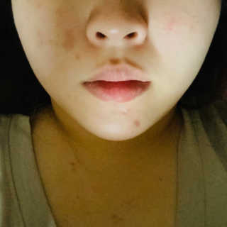 아이디플라코스메틱 아이디 페이스핏 마이너스 밴드 — 4점을 준 리뷰어가 2019년 12월 올린 사용 사진