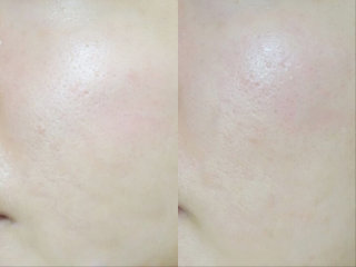 Yeon222님이 올린 리뷰 사진 2