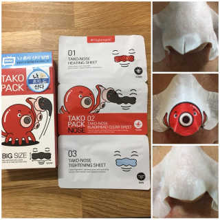 나이팅게일 TAKO PACK NOSE [문어코팩] — 5점을 준 리뷰어가 2018년 7월 올린 사용 사진