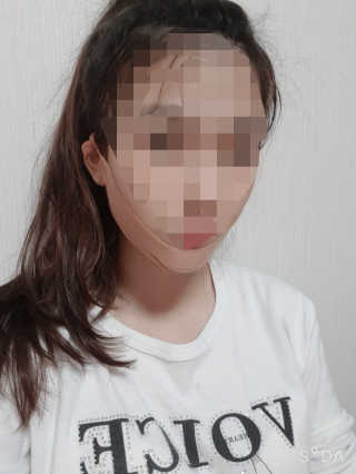 아이디플라코스메틱 아이디 페이스핏 마이너스 밴드 — 5점을 준 리뷰어가 2020년 3월 올린 사용 사진
