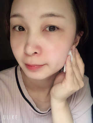 쏘내추럴 다이아 브라이트 토닝패드 — 4.5점을 준 리뷰어가 2019년 10월 올린 사용 사진