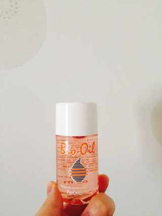 Bio-oil(바이오오일) 바이오오일(Bio-oil) — 5점을 준 리뷰어가 2017년 1월 올린 사용 사진