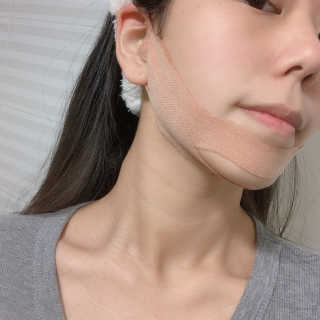 아이디플라코스메틱 아이디 페이스핏 마이너스 밴드 — 4점을 준 리뷰어가 2020년 1월 올린 사용 사진