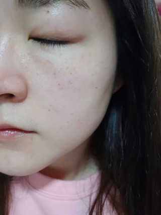 셀라피 에이리페어플러스크림 — 4.67점을 준 리뷰어가 2018년 3월 올린 사용 사진