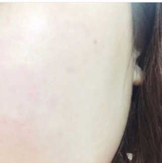 땡큐파머 백 투 아이슬란드 클렌징 워터 — 5점을 준 리뷰어가 2018년 3월 올린 사용 사진