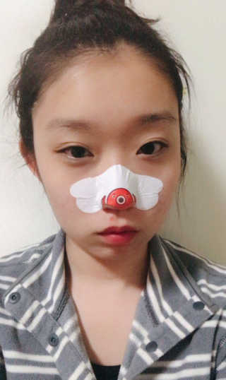 나이팅게일 TAKO PACK NOSE [문어코팩] — 3.5점을 준 리뷰어가 2017년 4월 올린 사용 사진