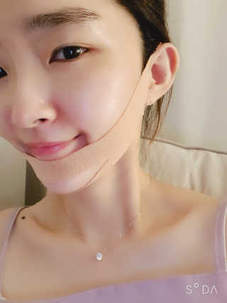 아이디플라코스메틱 아이디 페이스핏 마이너스 밴드 — 4점을 준 리뷰어가 2019년 9월 올린 사용 사진