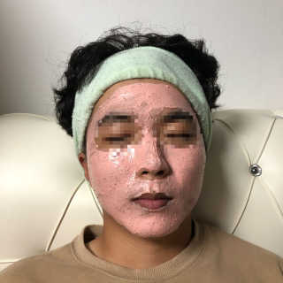 하프 문 아이즈 [하프문아이즈] 핑크 프루티X호지니 마스크팩 세트 — 5점을 준 리뷰어가 2019년 10월 올린 사용 사진