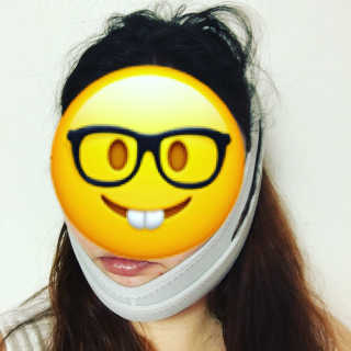 메디미 브이미 업 2스텝 브이라인벨트 — 3.33점을 준 리뷰어가 2017년 8월 올린 사용 사진