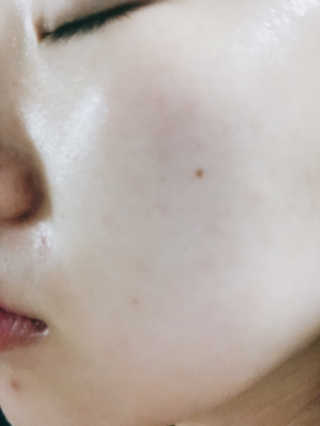 크리앙홀딩스 닥터 락슈미라 하이드로 앰플 — 3.5점을 준 리뷰어가 2019년 5월 올린 사용 사진