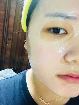 유리스킨-바이오셀룰로오스 마스크 젤리마스크 5매 — 4.33점을 준 리뷰어가 2018년 2월 올린 사용 사진