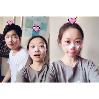 나이팅게일 TAKO PACK NOSE [문어코팩] — 5점을 준 리뷰어가 2017년 6월 올린 사용 사진