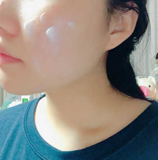 나이팅게일 티타민 크림 리뉴얼 — 3.67점을 준 리뷰어가 2018년 10월 올린 사용 사진