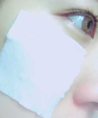 나이팅게일 광채토너130ml+더마 드레싱 코튼 100 SET — 3.5점을 준 리뷰어가 2018년 5월 올린 사용 사진