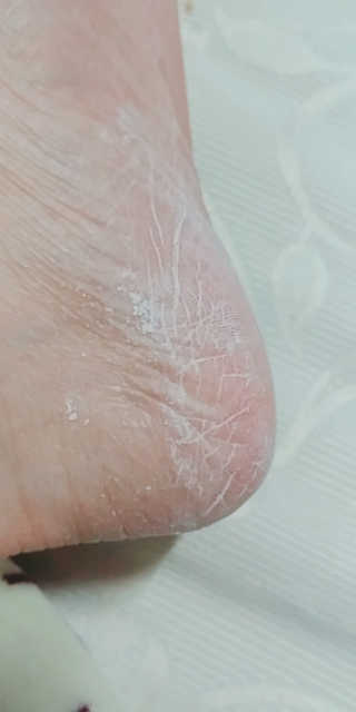 베베풋 글라스 베베풋글라스 — 4.33점을 준 리뷰어가 2019년 2월 올린 사용 사진