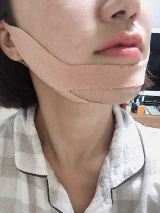 아이디플라코스메틱 아이디 페이스핏 마이너스 밴드 — 4점을 준 리뷰어가 2019년 10월 올린 사용 사진
