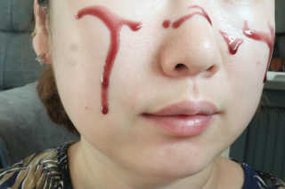 쏘내추럴 레드 필 팅글 세럼 오리지널 — 4.5점을 준 리뷰어가 2019년 8월 올린 사용 사진