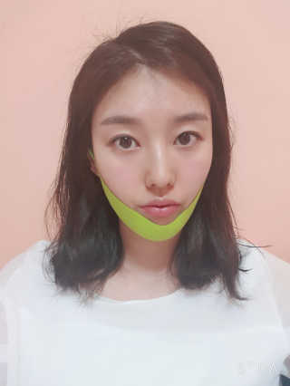 스케덤 시카 리프팅밴드 — 3.5점을 준 리뷰어가 2019년 4월 올린 사용 사진