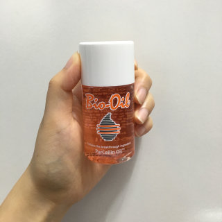 Bio-oil(바이오오일) 바이오오일(Bio-oil) — 3.5점을 준 리뷰어가 2016년 8월 올린 사용 사진