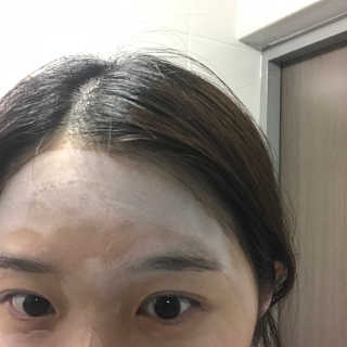 셀퓨전씨 트리악 포어 딜리트 버블 팩 — 3.5점을 준 리뷰어가 2018년 4월 올린 사용 사진