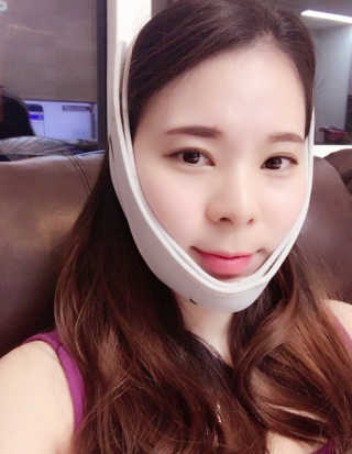 메디미 브이미 업 2스텝 브이라인벨트 — 5점을 준 리뷰어가 2017년 6월 올린 사용 사진