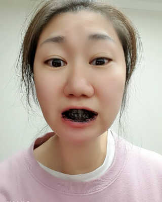 the naked object 디블랙팩치약 디블랙칫솔 세트 — 5점을 준 리뷰어가 2020년 3월 올린 사용 사진