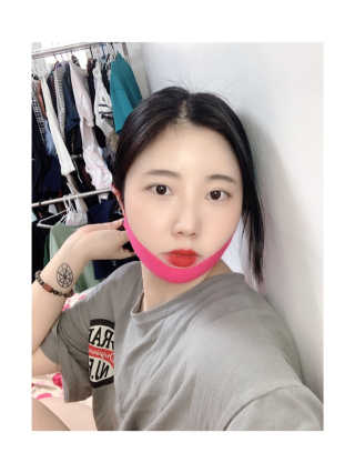 스케덤 펩타이드 리프팅밴드 — 5점을 준 리뷰어가 2019년 6월 올린 사용 사진