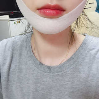 스케덤 클루덤 리프팅 패치 — 3점을 준 리뷰어가 2019년 3월 올린 사용 사진