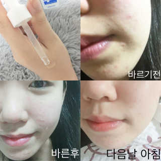 아이소이 파란소화기 응급스팟 — 5점을 준 리뷰어가 2017년 7월 올린 사용 사진