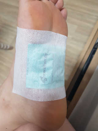 메디테라피 더마 릴렉스 힐링패치 — 1점을 준 리뷰어가 2018년 5월 올린 사용 사진