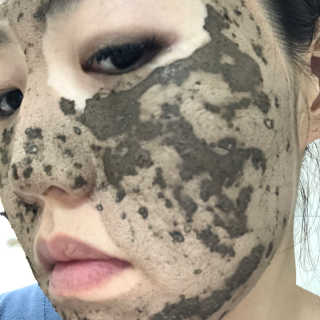 글랜무어 포어 포졸라닉 타이트닝 팩 — 5점을 준 리뷰어가 2018년 5월 올린 사용 사진