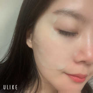 [더마펌] 인텐시브케어 아이존 패치 — 5점을 준 리뷰어가 2019년 10월 올린 사용 사진