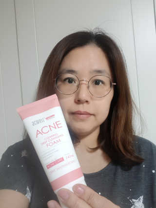 아크웰 아크네 클리어링 딥 클렌징 폼 — 5점을 준 리뷰어가 2018년 12월 올린 사용 사진