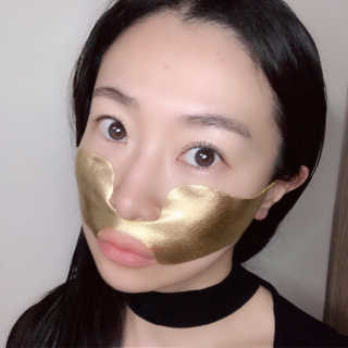 [스케덤] 상악밴드 — 4점을 준 리뷰어가 2019년 6월 올린 사용 사진