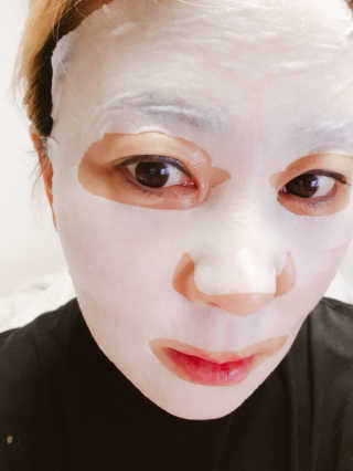 유산균하우스 [프로바이오닉]스킨프로바이오틱스 마스크 10매입 — 5점을 준 리뷰어가 2019년 2월 올린 사용 사진