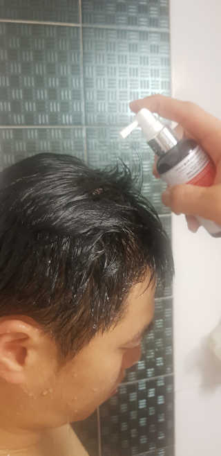닥터모두 홈스파 스칼프 샴푸 300ml + 헤어토닉 — 4점을 준 리뷰어가 2019년 2월 올린 사용 사진
