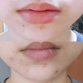 셀라피 에이리페어플러스크림 — 4.33점을 준 리뷰어가 2018년 4월 올린 사용 사진