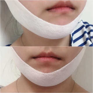스케덤 클루덤 리프팅 패치 — 4.5점을 준 리뷰어가 2019년 4월 올린 사용 사진