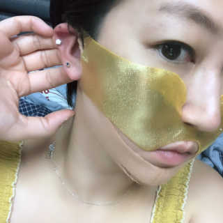 [스케덤] 상악밴드 — 3.5점을 준 리뷰어가 2019년 9월 올린 사용 사진
