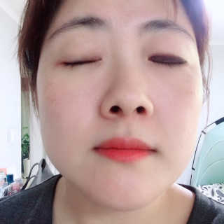 [더메디닥터] 글리셜 미셀라 클렌징 워터 — 4점을 준 리뷰어가 2019년 3월 올린 사용 사진
