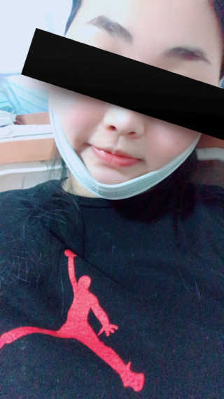 메디미 브이미 업 2스텝 브이라인벨트 — 3점을 준 리뷰어가 2017년 8월 올린 사용 사진