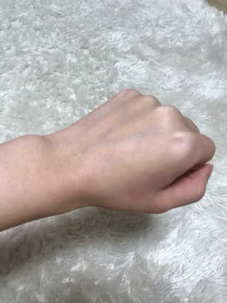 메디필 에스테 더마 레드마린 콜라겐 토너 — 2.5점을 준 리뷰어가 2020년 1월 올린 사용 사진