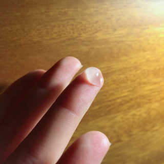 세바메드 클리어 페이스 스팟 컨트롤 젤 — 3.83점을 준 리뷰어가 2017년 11월 올린 사용 사진